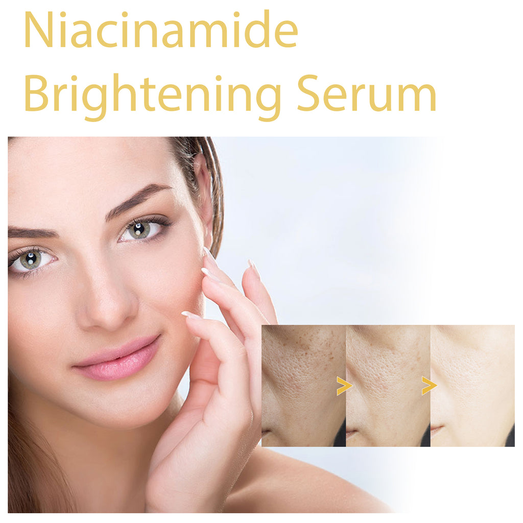 HOYGI Niacinamide Brightening Serum, Lightening Spots And Fine Lines Brightening Skin Hydrating Moisturizing Facial Treatment
